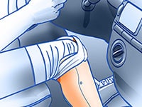 Protesi arti inferiori (03.02)